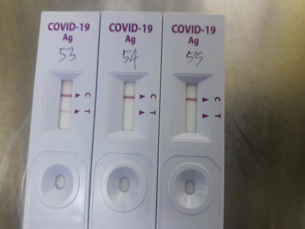 PCR VS አንቲጂን ሙከራ-ከየትኛው ኮርዮሽ-19 ሙከራ ለእኔ ትክክል ነው?